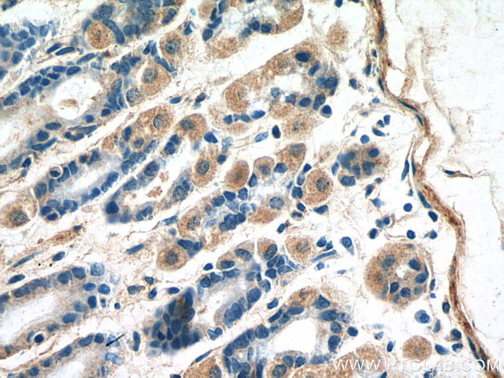 Immunohistochemistry (IHC) staining of mouse stomach tissue using B4GALNT3 Polyclonal antibody (24675-1-AP)