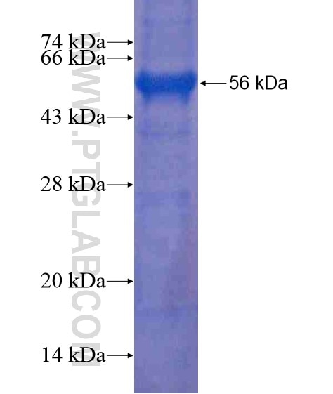 B4GALNT3 fusion protein Ag20342 SDS-PAGE