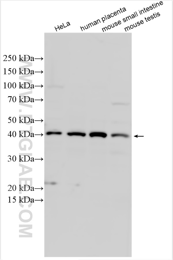 Western Blot (WB) analysis of various lysates using B4GALT1 Polyclonal antibody (55448-1-AP)