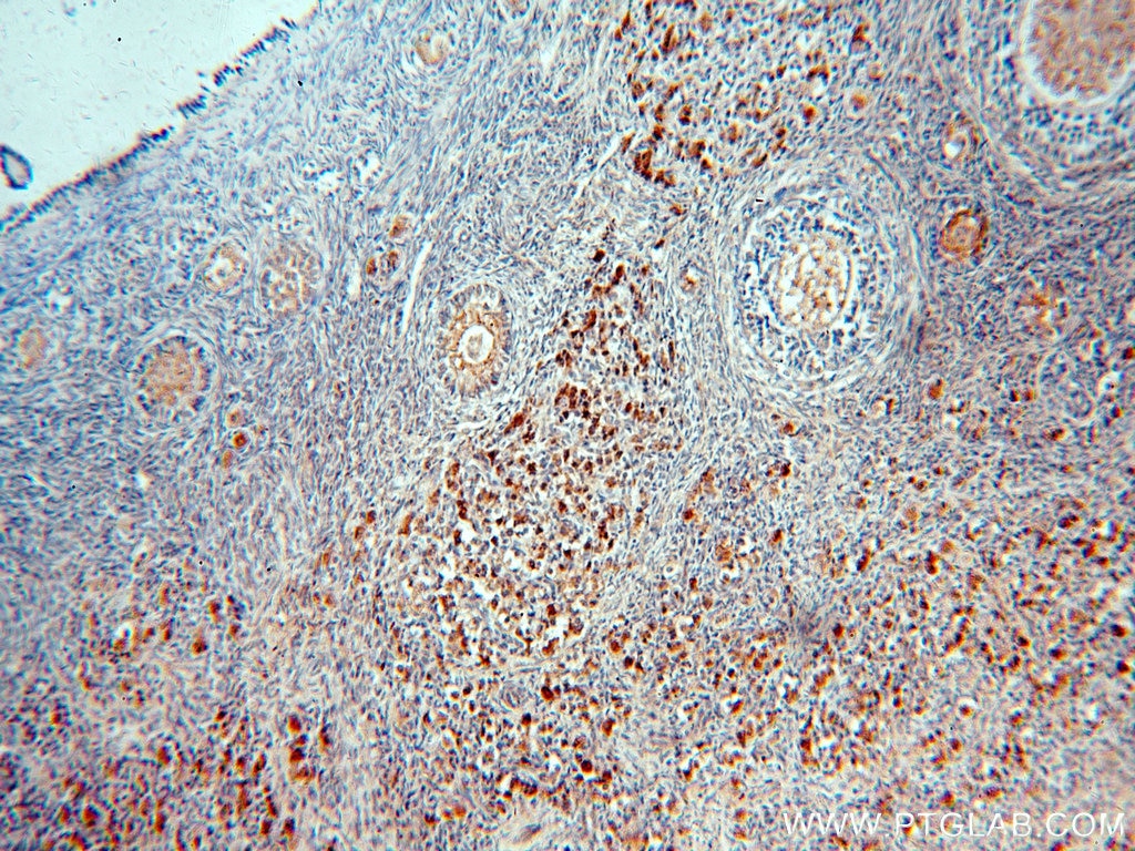 Immunohistochemistry (IHC) staining of human ovary tissue using B4GALT2 Polyclonal antibody (20330-1-AP)