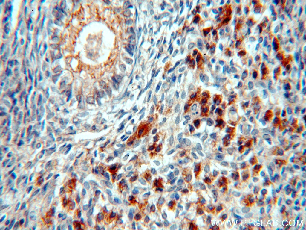 Immunohistochemistry (IHC) staining of human ovary tissue using B4GALT2 Polyclonal antibody (20330-1-AP)