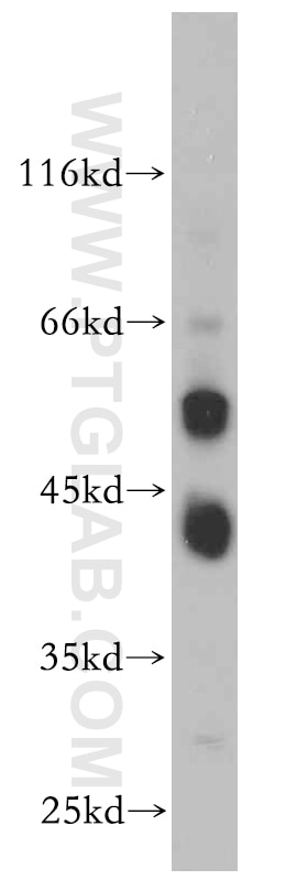 Western Blot (WB) analysis of mouse brain tissue using B4GALT2 Polyclonal antibody (20330-1-AP)