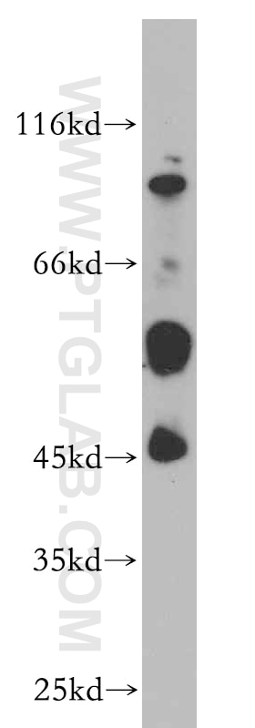 Western Blot (WB) analysis of mouse skeletal muscle tissue using B4GALT2 Polyclonal antibody (20330-1-AP)