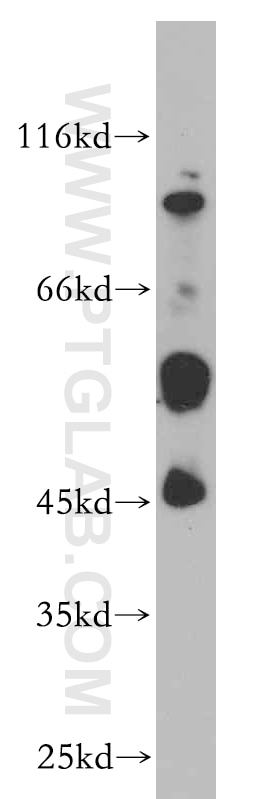 WB analysis of mouse skeletal muscle using 20330-1-AP