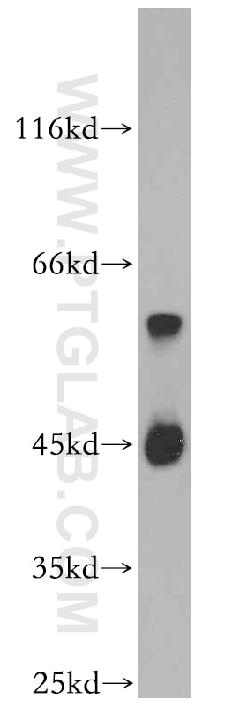 Western Blot (WB) analysis of PC-3 cells using B4GALT2 Polyclonal antibody (20330-1-AP)