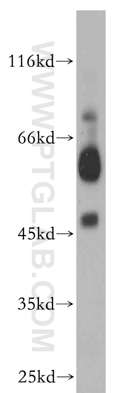 Western Blot (WB) analysis of mouse large intestine tissue using B4GALT2 Polyclonal antibody (20330-1-AP)