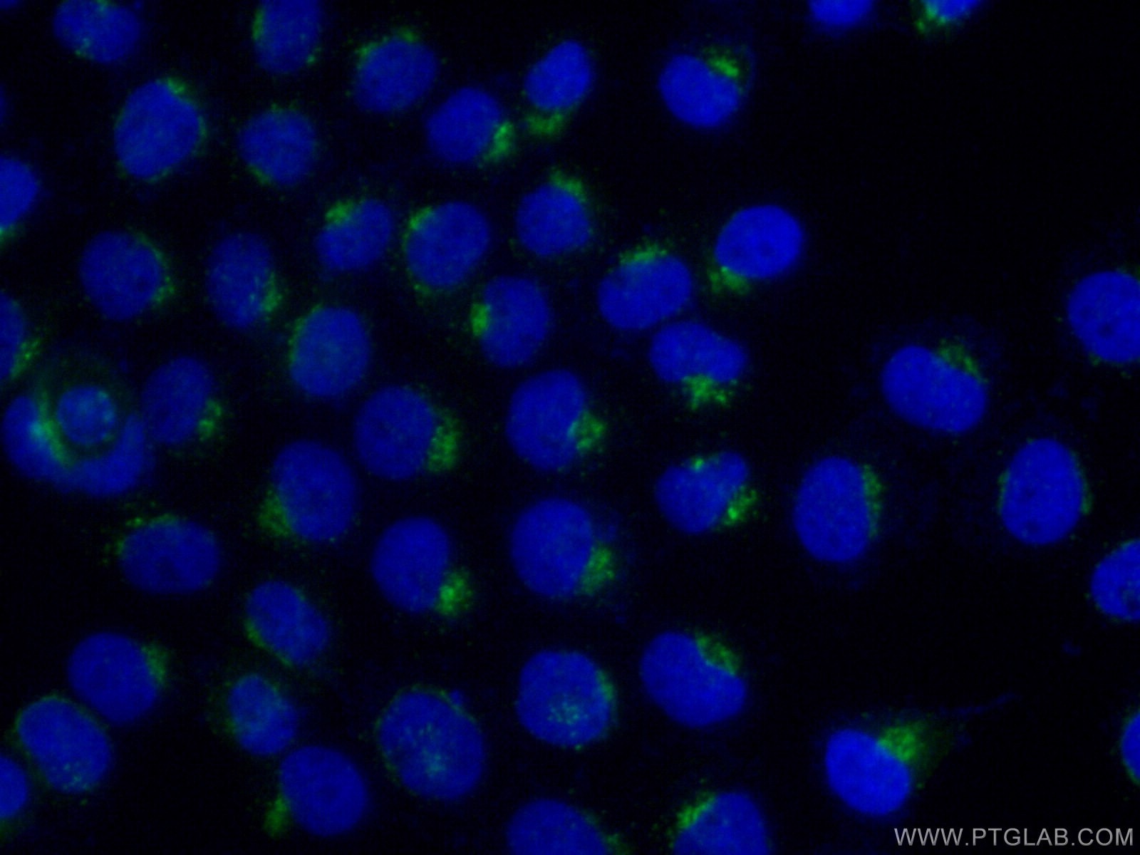 Immunofluorescence (IF) / fluorescent staining of A431 cells using B4GALT3 Polyclonal antibody (11041-1-AP)