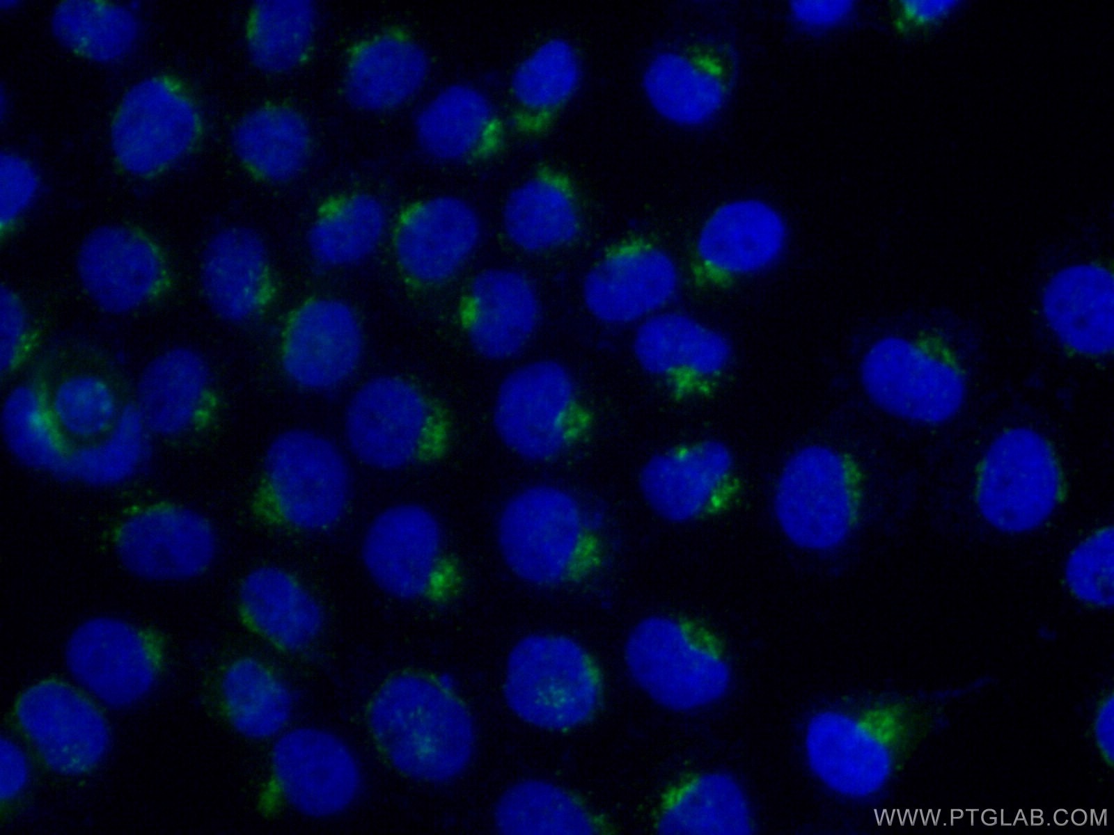 IF Staining of A431 using 11041-1-AP