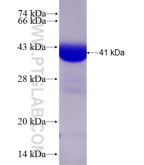 B4GALT3 fusion protein Ag28038 SDS-PAGE