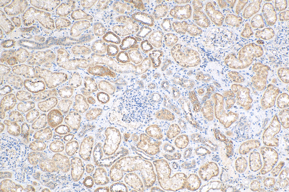 Immunohistochemistry (IHC) staining of human kidney tissue using B4GALT4 Polyclonal antibody (15200-1-AP)