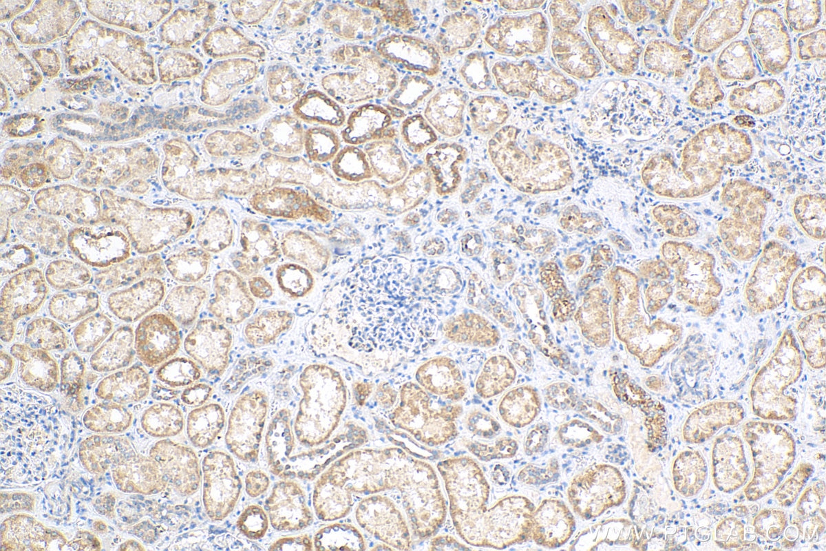 IHC staining of human kidney using 15200-1-AP