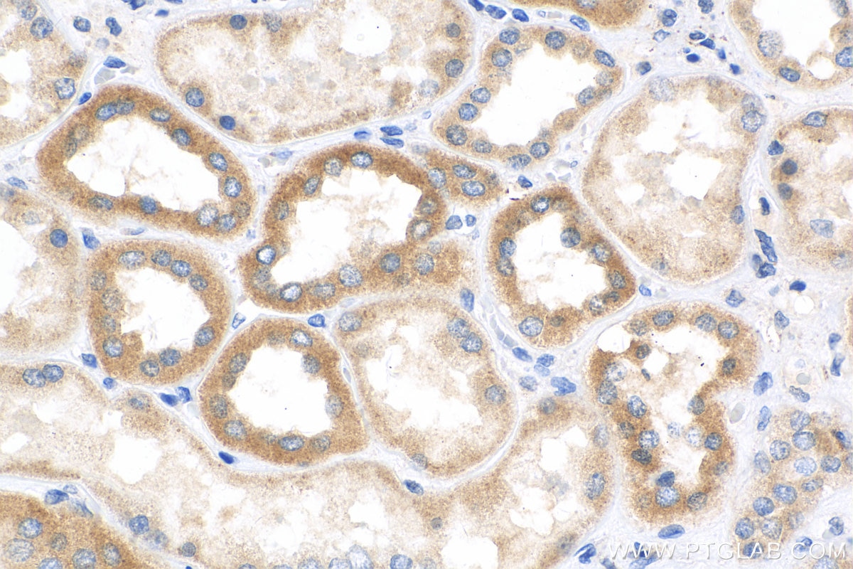 Immunohistochemistry (IHC) staining of human kidney tissue using B4GALT4 Polyclonal antibody (15200-1-AP)