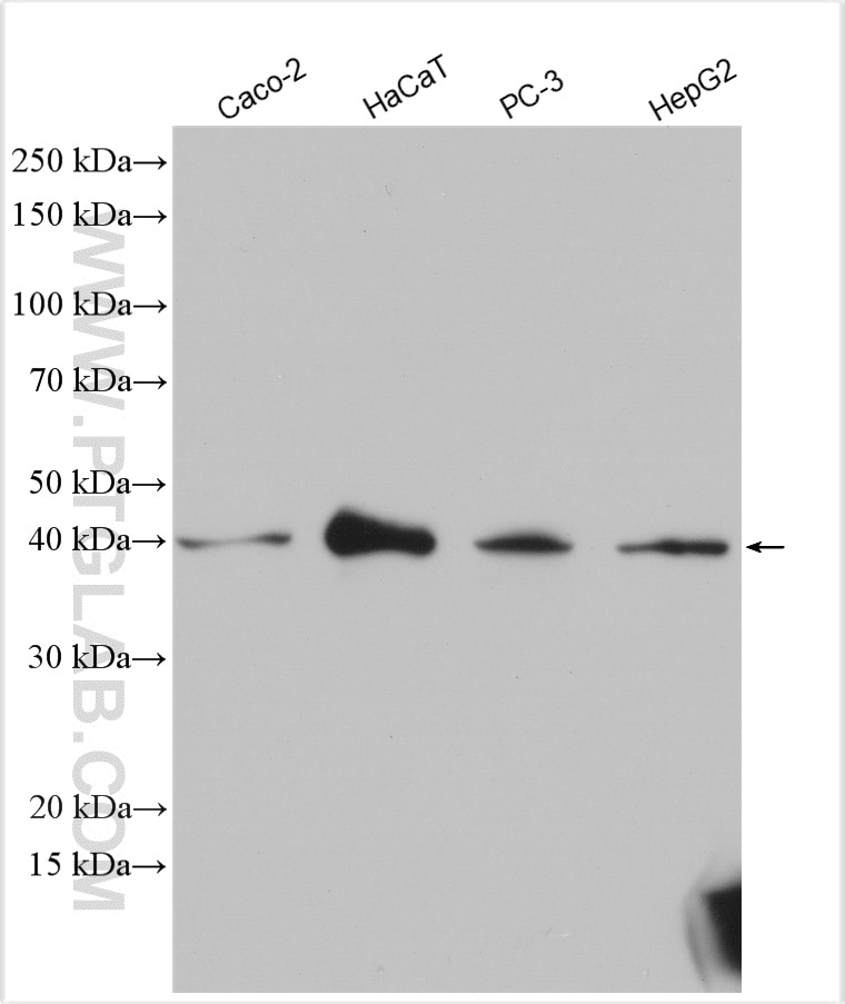 Western Blot (WB) analysis of various lysates using B4GALT4 Polyclonal antibody (15200-1-AP)