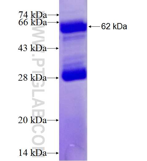 B4GALT4 fusion protein Ag7348 SDS-PAGE