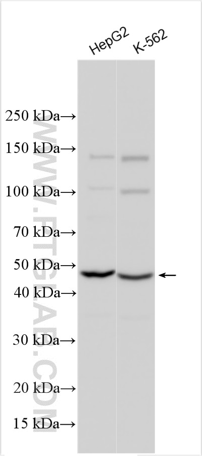 WB analysis using 17846-1-AP Western Blot (WB) analysis of various lysates using B4GALT5 Polyclonal antibody (17846-1-AP)