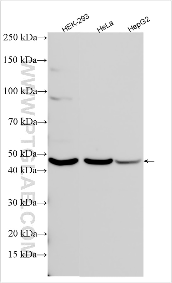 WB analysis using 17846-1-AP Western Blot (WB) analysis of various lysates using B4GALT5 Polyclonal antibody (17846-1-AP)