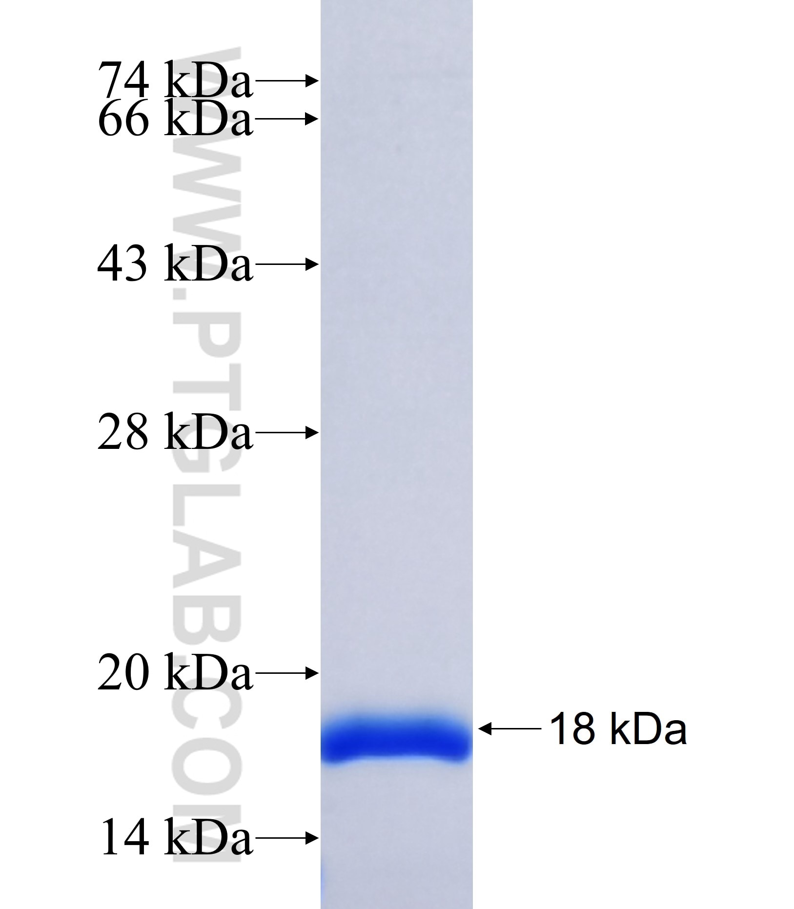 B4GALT5 fusion protein Ag37062 SDS-PAGE B4GALT5 fusion protein Ag37062 SDS-PAGE