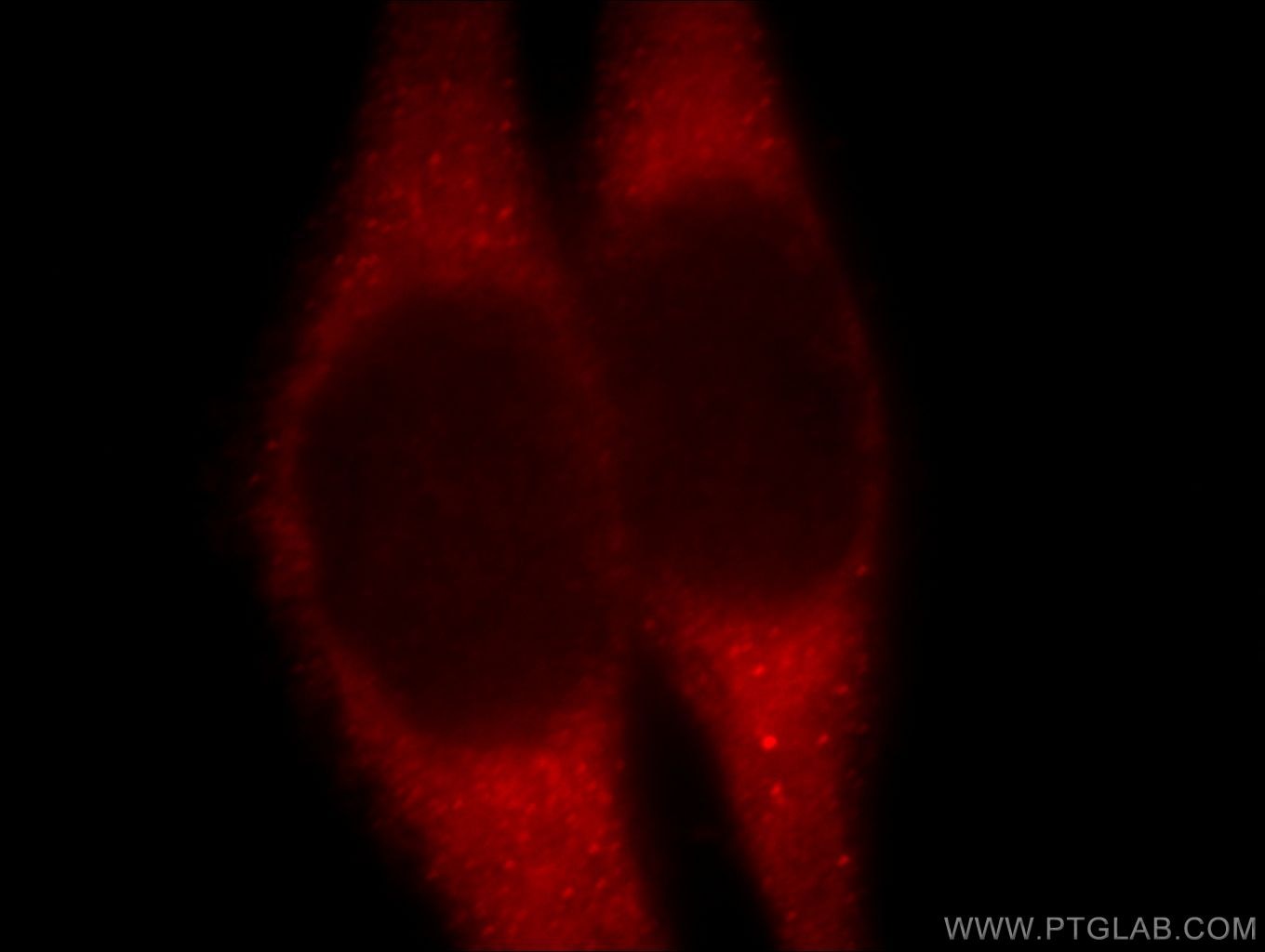 Immunofluorescence (IF) / fluorescent staining of HeLa cells using B4GALT6 Polyclonal antibody (20148-1-AP)