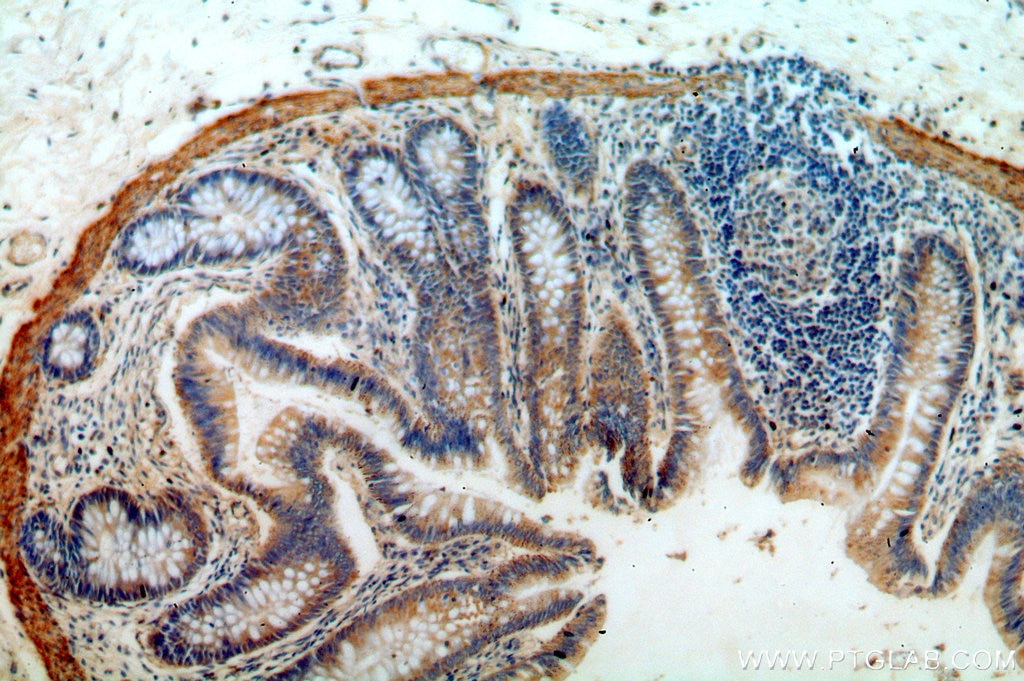 Immunohistochemistry (IHC) staining of human colon tissue using B4GALT6 Polyclonal antibody (20148-1-AP)