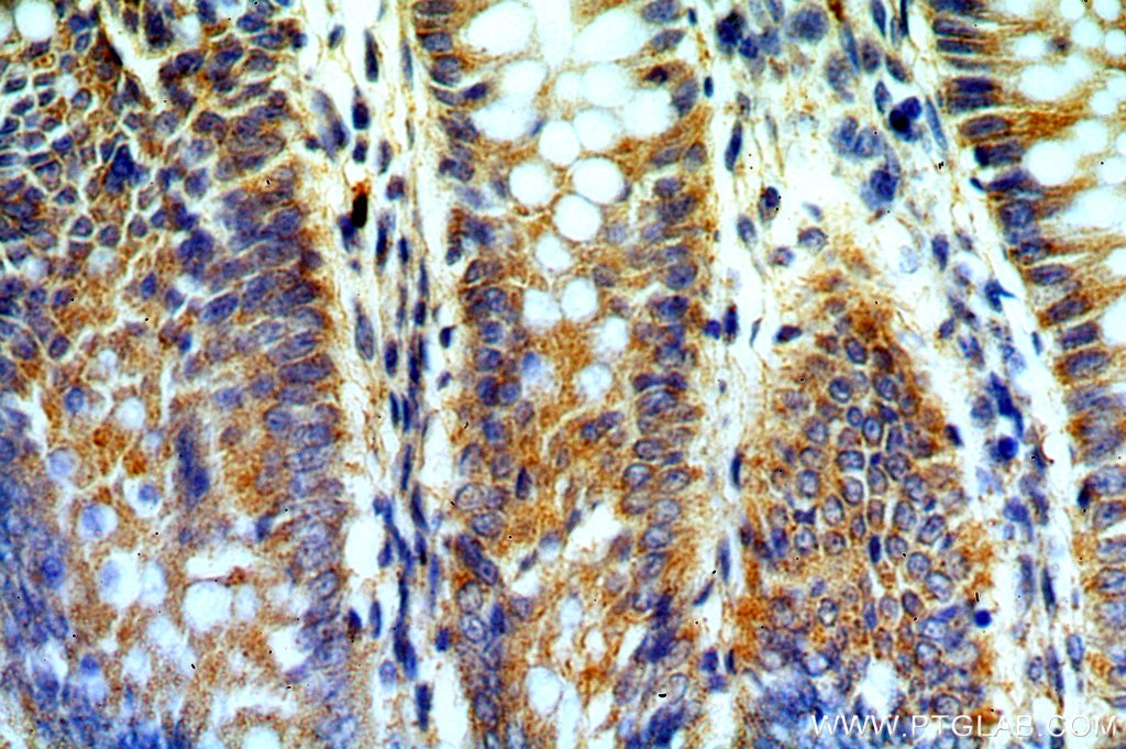 Immunohistochemistry (IHC) staining of human colon tissue using B4GALT6 Polyclonal antibody (20148-1-AP)