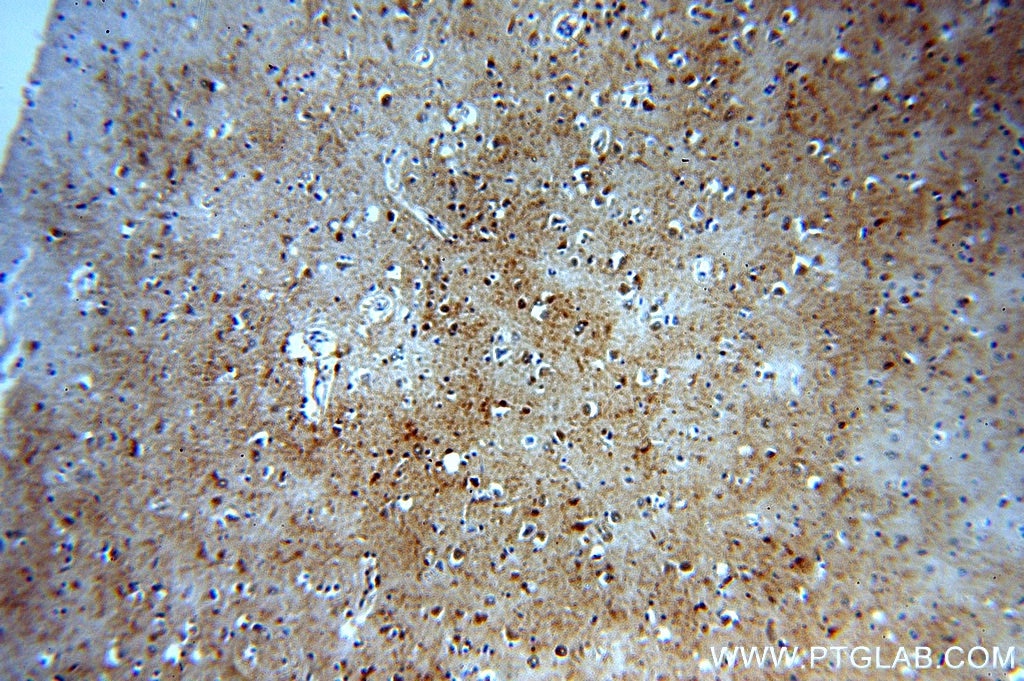 Immunohistochemistry (IHC) staining of human brain tissue using B4GALT6 Polyclonal antibody (20148-1-AP)