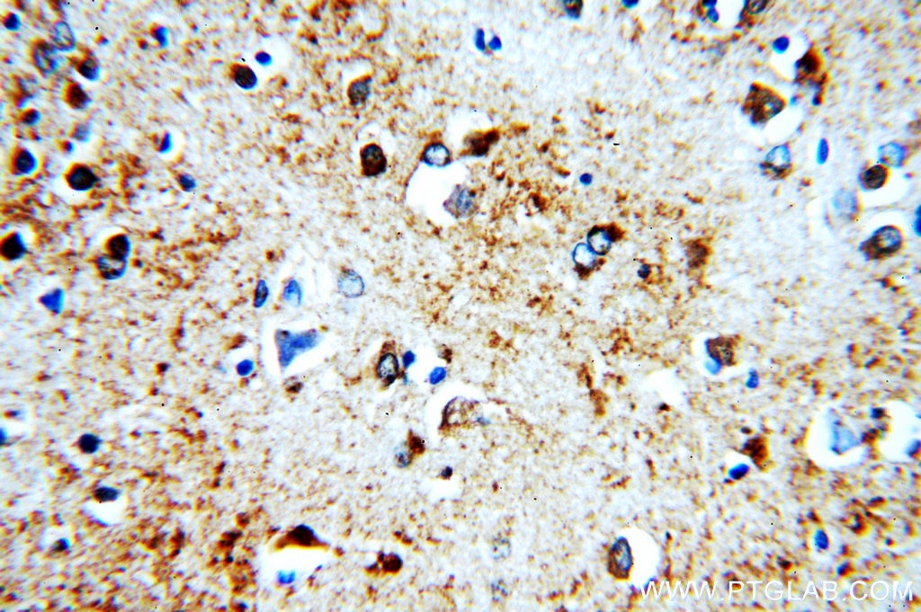Immunohistochemistry (IHC) staining of human brain tissue using B4GALT6 Polyclonal antibody (20148-1-AP)