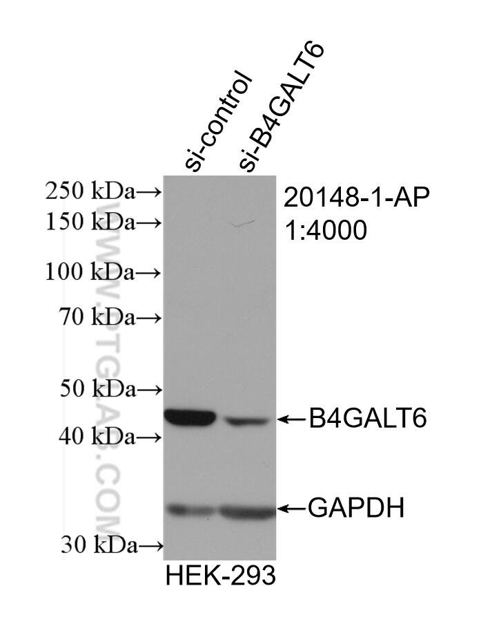 Western Blot (WB) analysis of HEK-293 cells using B4GALT6 Polyclonal antibody (20148-1-AP)