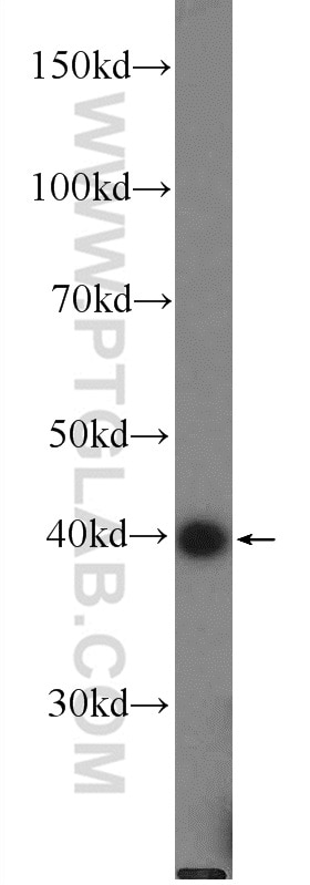 Western Blot (WB) analysis of mouse brain tissue using B4GALT6 Polyclonal antibody (20148-1-AP)