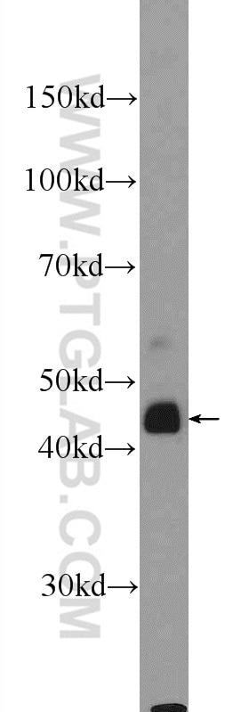 Western Blot (WB) analysis of HEK-293 cells using B4GALT6 Polyclonal antibody (20148-1-AP)