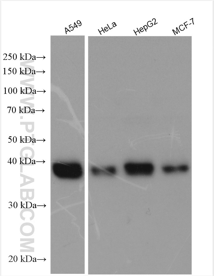 Western Blot (WB) analysis of various lysates using B4GALT7 Polyclonal antibody (10535-1-AP)