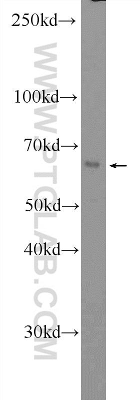 Western Blot (WB) analysis of RAW 264.7 cells using CD80/B7-1 Polyclonal antibody (14292-1-AP)