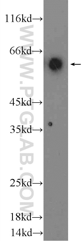 WB analysis of human peripheral blood leukocyte using 14292-1-AP