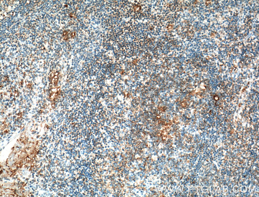 Immunohistochemistry (IHC) staining of human tonsillitis tissue using CD80/B7-1 Monoclonal antibody (66406-1-Ig)