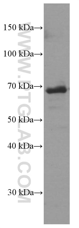 Western Blot (WB) analysis of Daudi cells using CD80/B7-1 Monoclonal antibody (66406-1-Ig)
