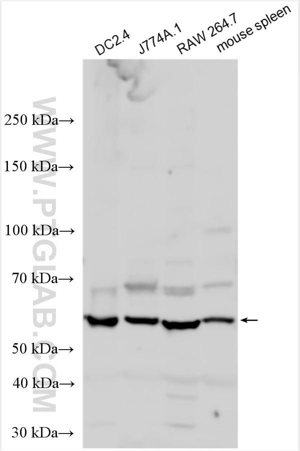 Western Blot (WB) analysis of various lysates using CD86 Polyclonal antibody (30691-1-AP)