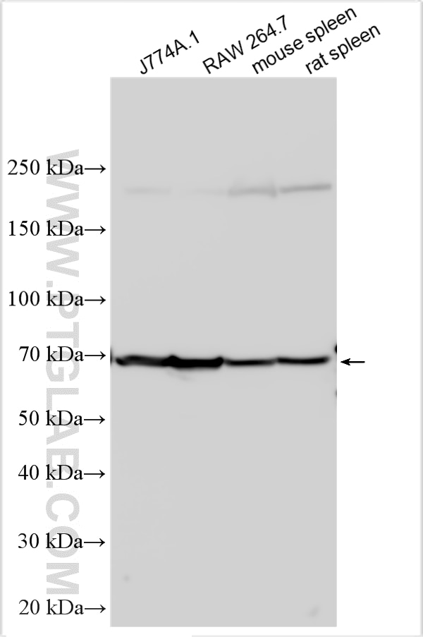 Western Blot (WB) analysis of various lysates using CD86 Polyclonal antibody (30691-1-AP)