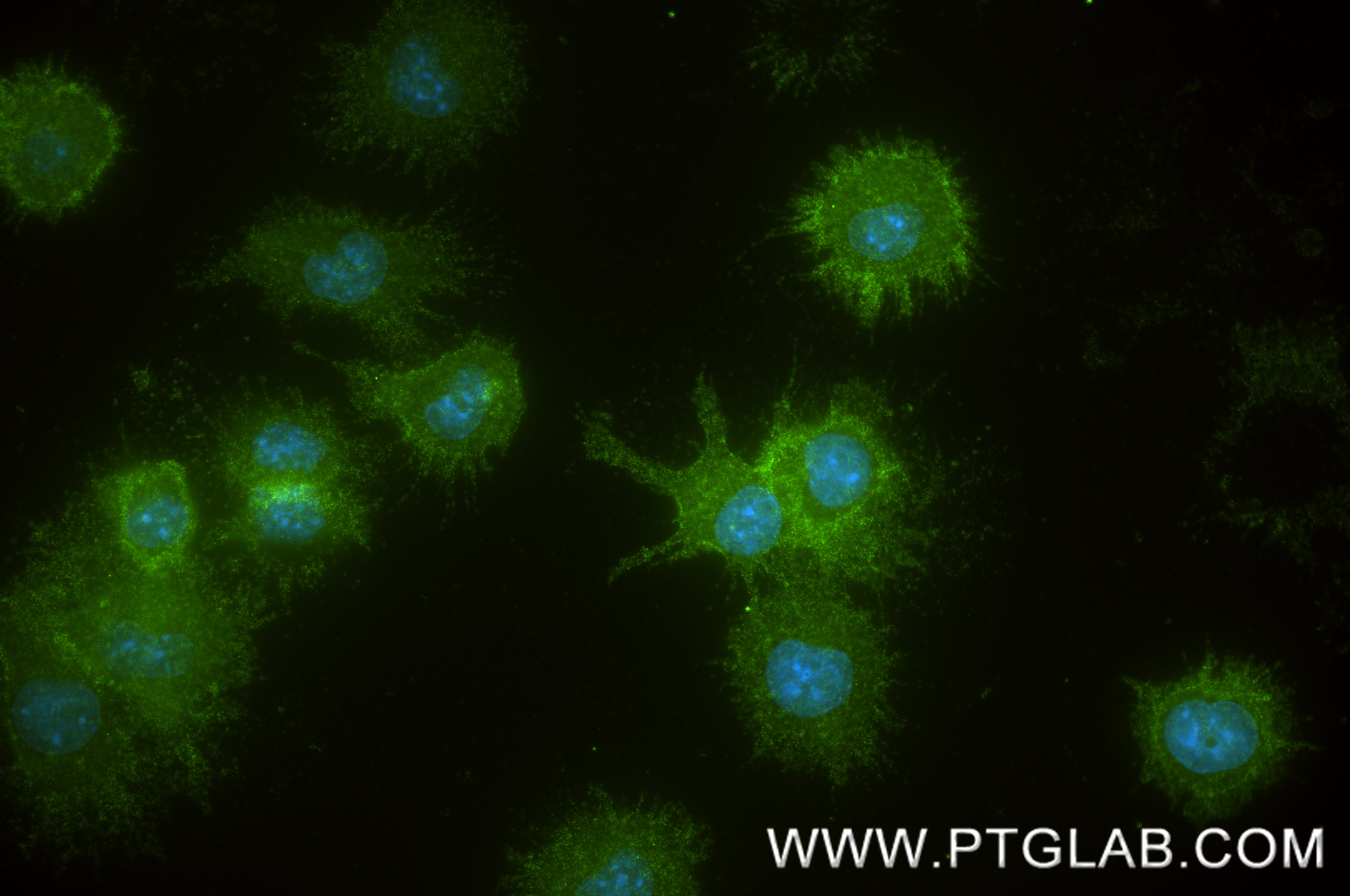 IF Staining of DC2.4 using 83213-10-RR Immunofluorescence (IF) / fluorescent staining of DC2.4 cells using CD86 Recombinant monoclonal antibody (83213-10-RR)