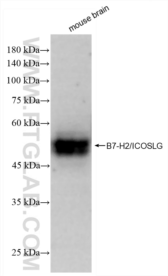 Western Blot (WB) analysis of mouse brain tissue using ICOSLG/B7-H2/CD275 Recombinant antibody (83375-2-RR)