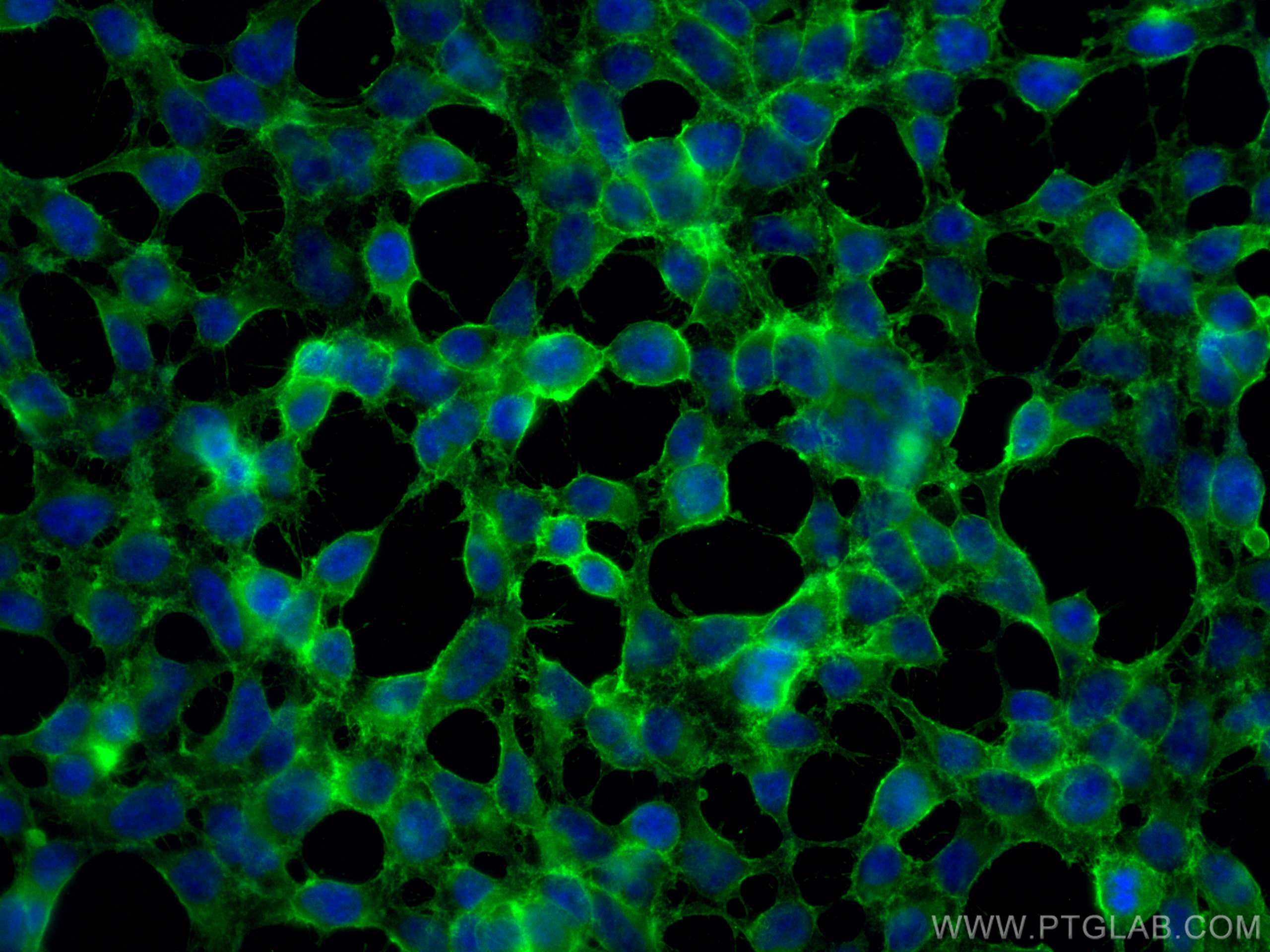 Immunofluorescence (IF) / fluorescent staining of HEK-293 cells using B7-H3 Polyclonal antibody (30052-1-AP)