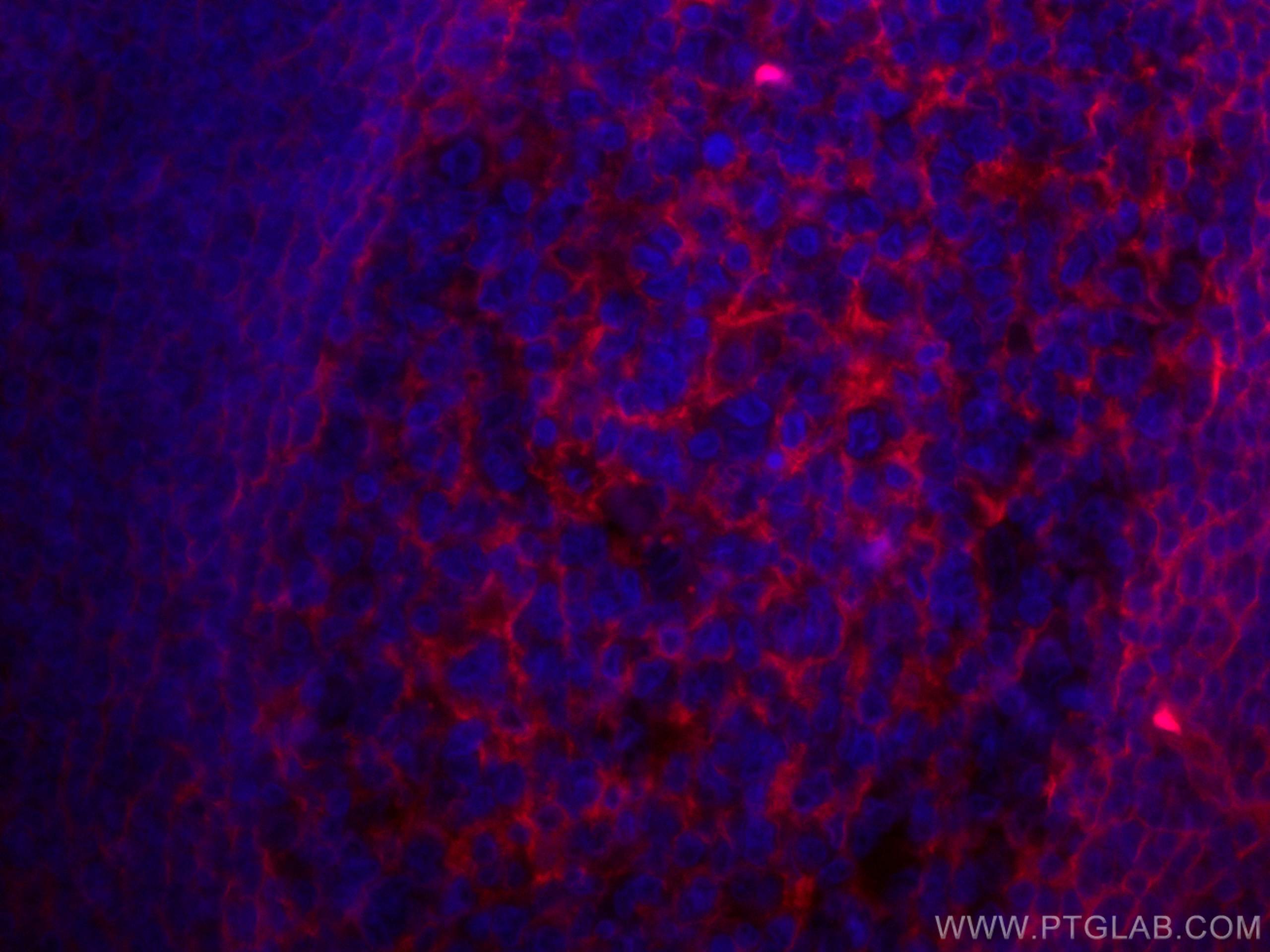 Immunofluorescence (IF) / fluorescent staining of human tonsillitis tissue using CoraLite®594-conjugated B7-H3 Monoclonal antibody (CL594-66481)