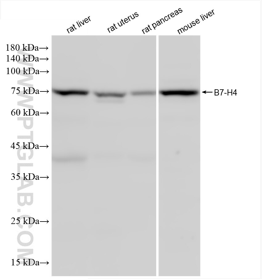 Western Blot (WB) analysis of various lysates using B7-H4 Recombinant antibody (86484-1-RR)