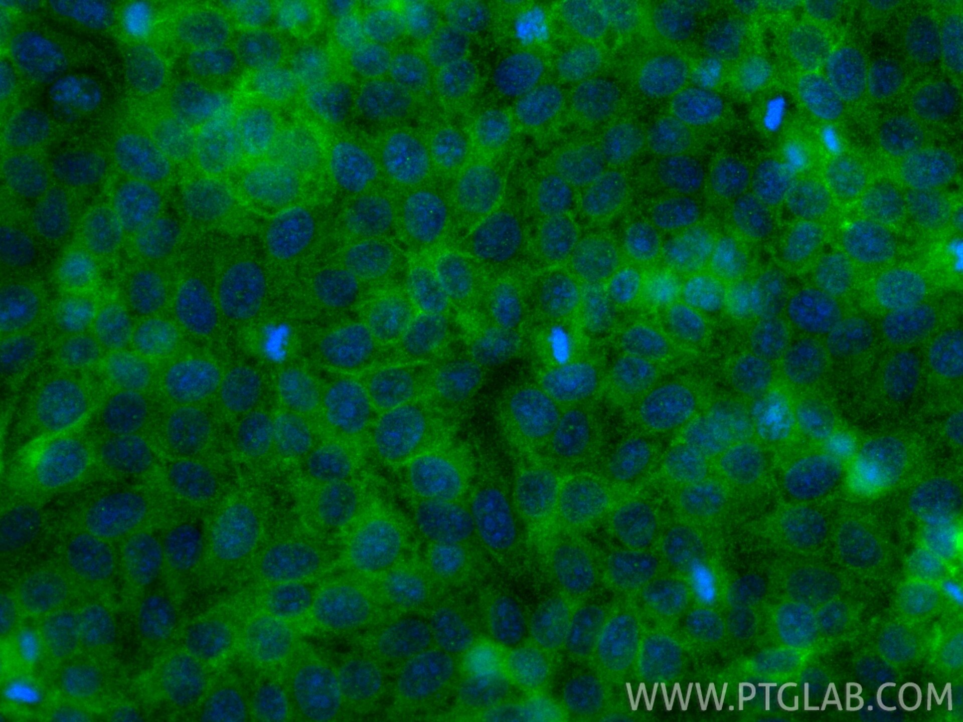Immunofluorescence (IF) / fluorescent staining of HepG2 cells using B7-H6 Polyclonal antibody (31620-1-AP)