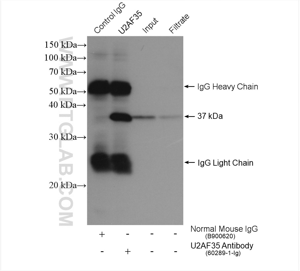 IP sample detected with different secondary antibodies. Normal Mouse IgG (B900620) as control.