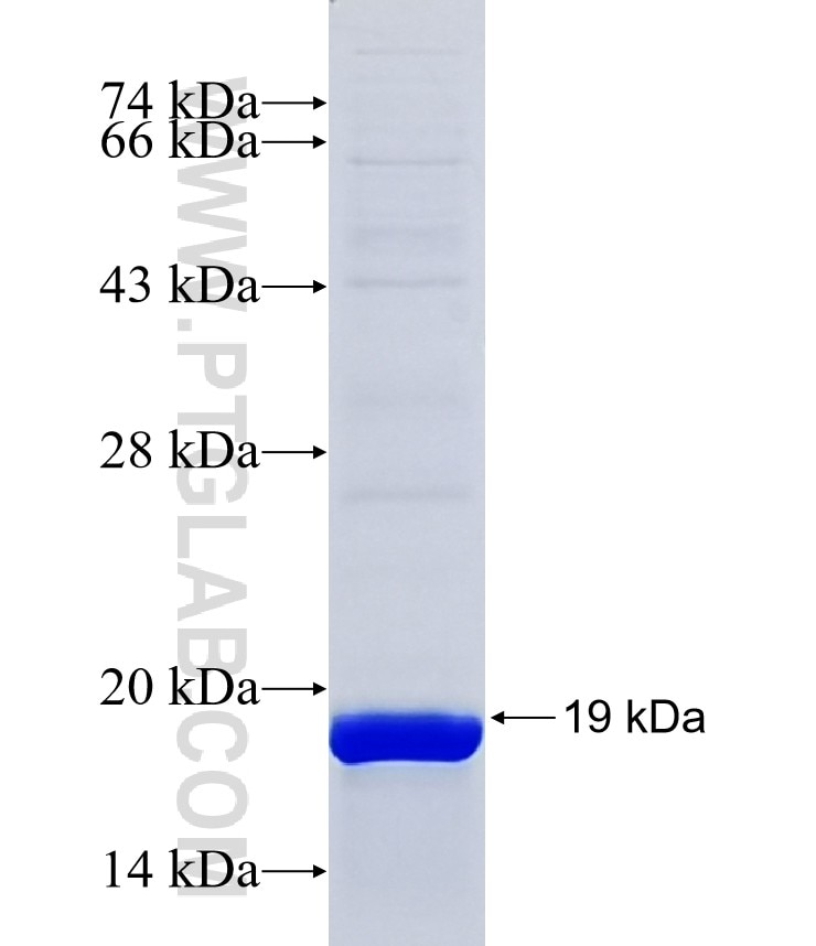 B9D1 fusion protein Ag38285 SDS-PAGE B9D1 fusion protein Ag38285 SDS-PAGE