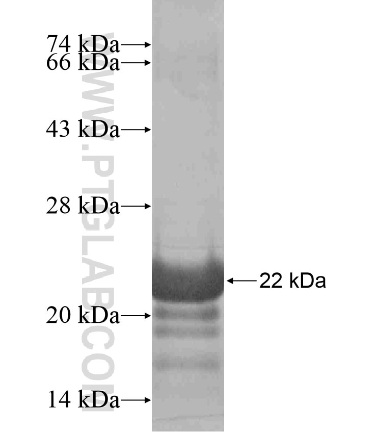 B9D2 fusion protein Ag17104 SDS-PAGE