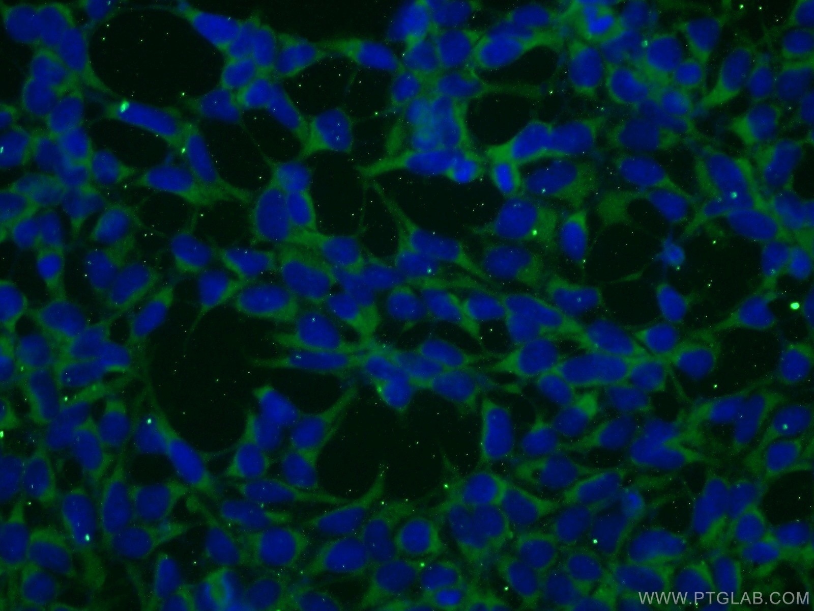 IF Staining of HEK-293 using 24997-1-AP