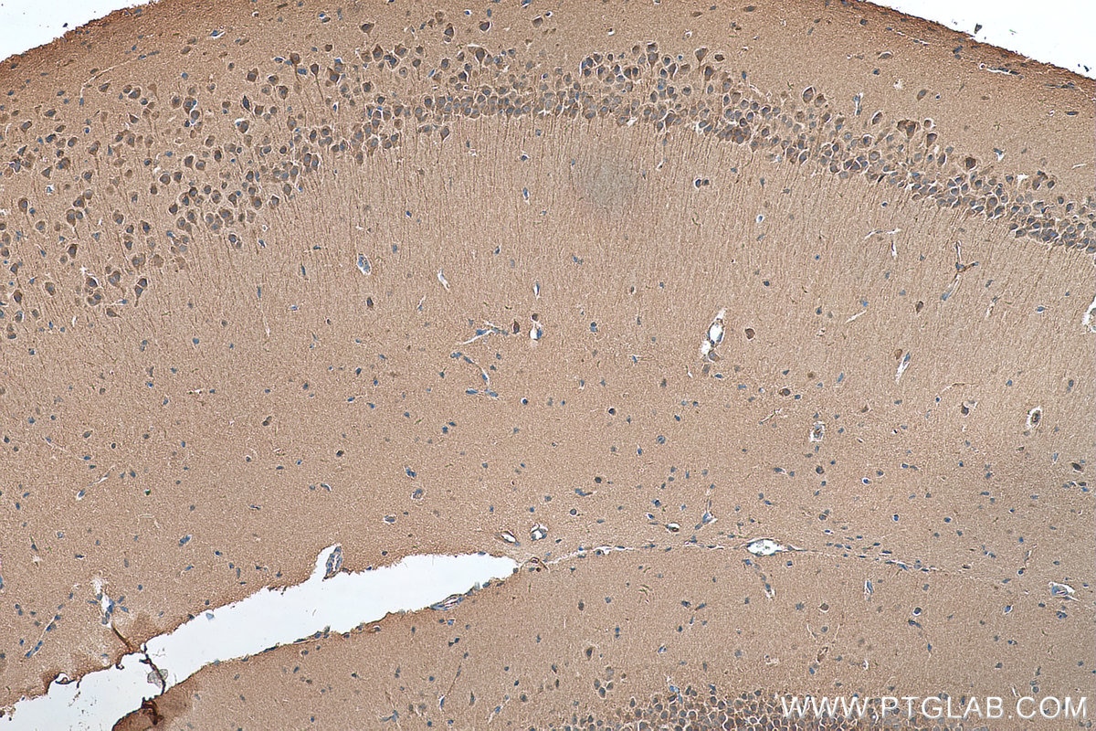 Immunohistochemistry (IHC) staining of mouse brain tissue using BAALC Polyclonal antibody (24997-1-AP)