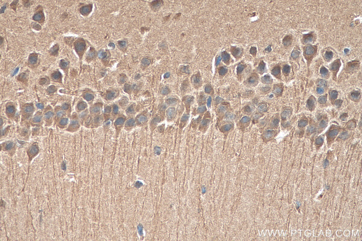 IHC staining of mouse brain using 24997-1-AP