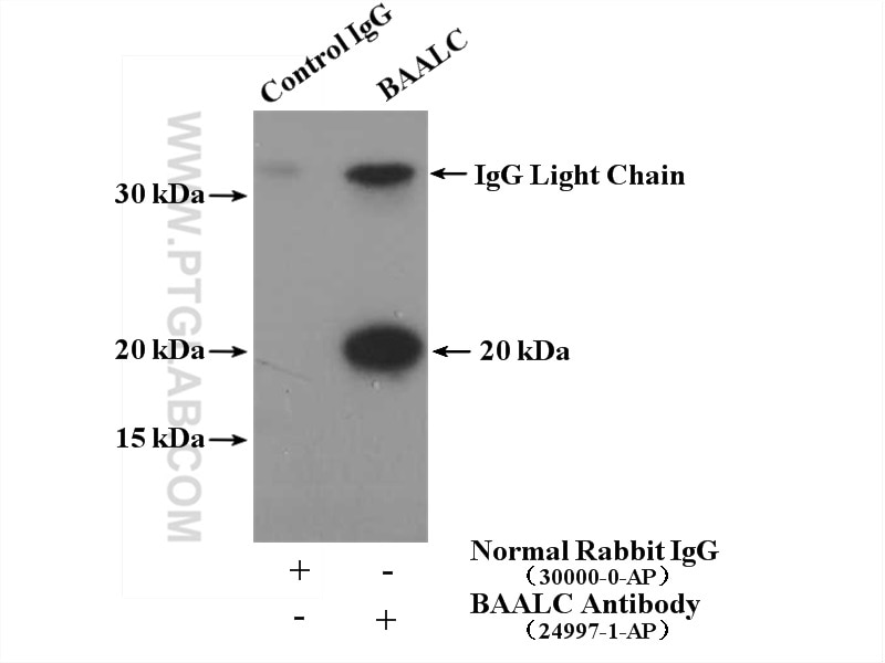 Immunoprecipitation (IP) experiment of mouse brain tissue using BAALC Polyclonal antibody (24997-1-AP)