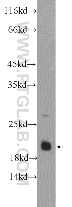 Western Blot (WB) analysis of mouse brain tissue using BAALC Polyclonal antibody (24997-1-AP)